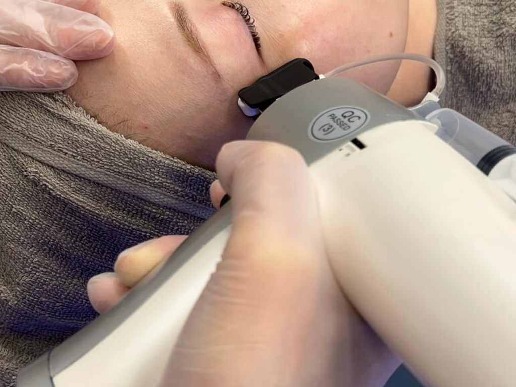 肌の奥まで届く最新マシン