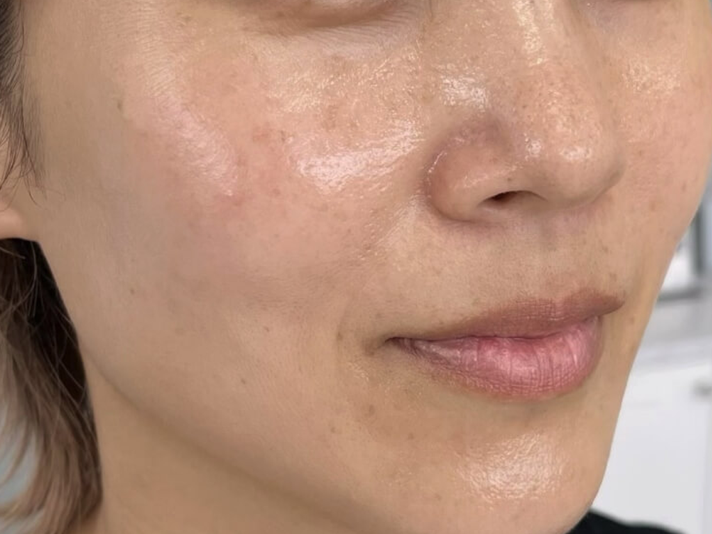 ほとんどないダウンタイム